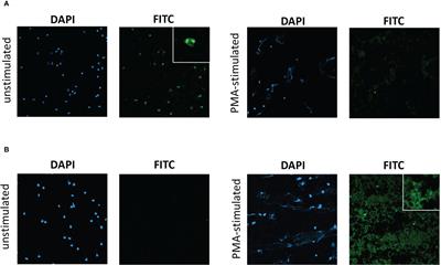 Identification of autoantigens and their potential post-translational modification in EGPA and severe eosinophilic asthma